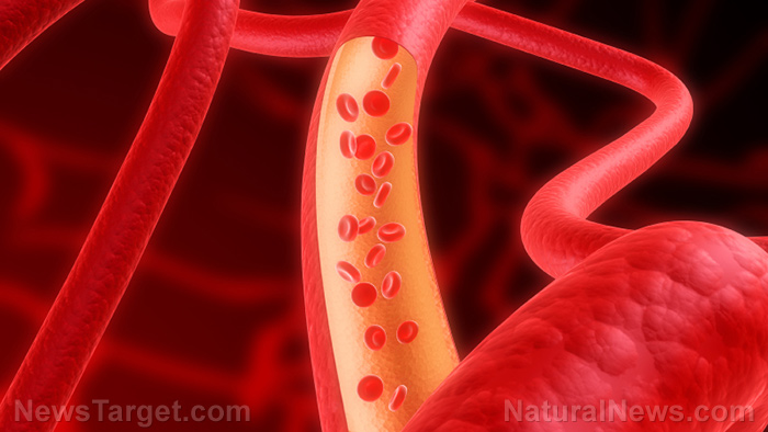 What is your arterial age? Lower your blood pressure naturally to extend your life
