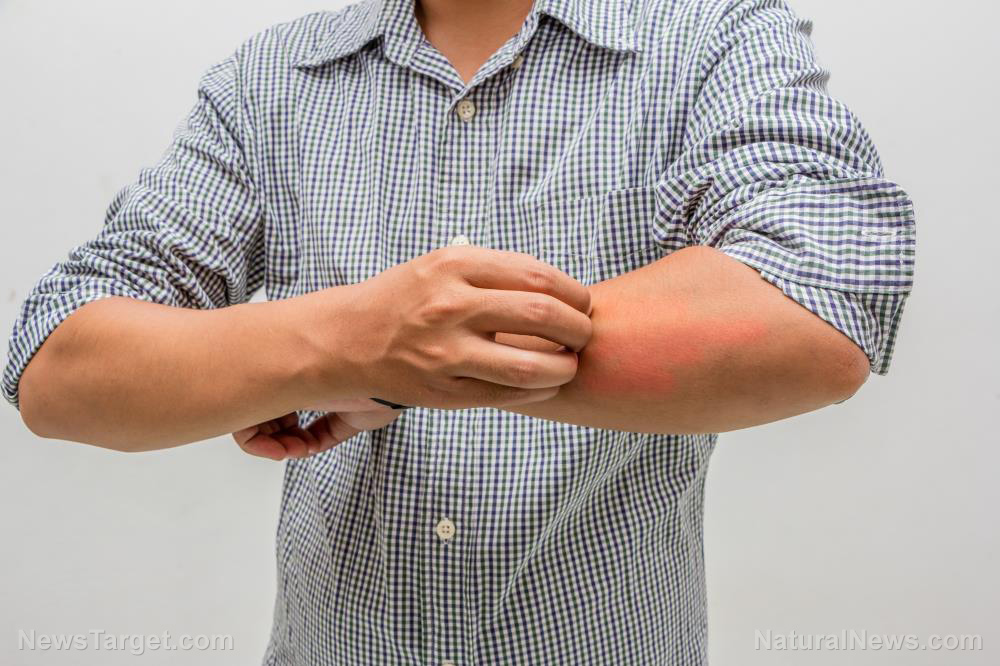 Your itchy skin may indicate a kidney condition; research finds a connection